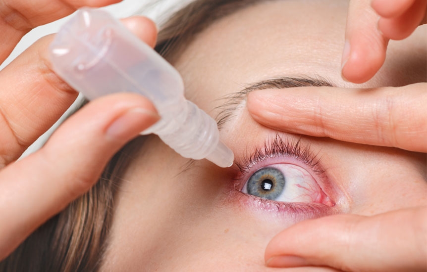 علت خشکی چشم و درمان آن