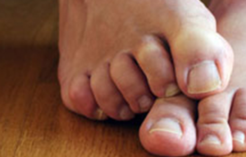سندروم پای بی قرار چیست و چگونه درمان می‌شود؟